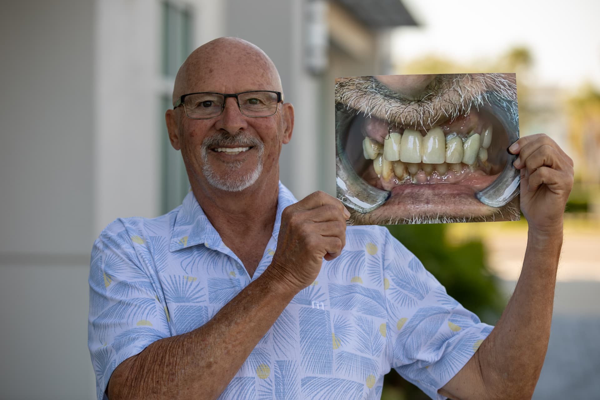 Robert, dental implant patient at Speranza Dental Implant Centers